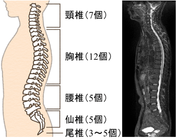 頸椎(7個)胸椎(12個)腰椎(5個)仙椎(5個)尾椎(3～5個)